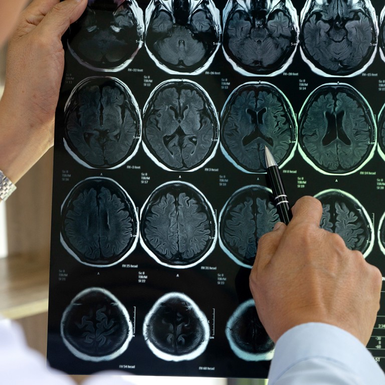 What are the typical causes of a brain injury?