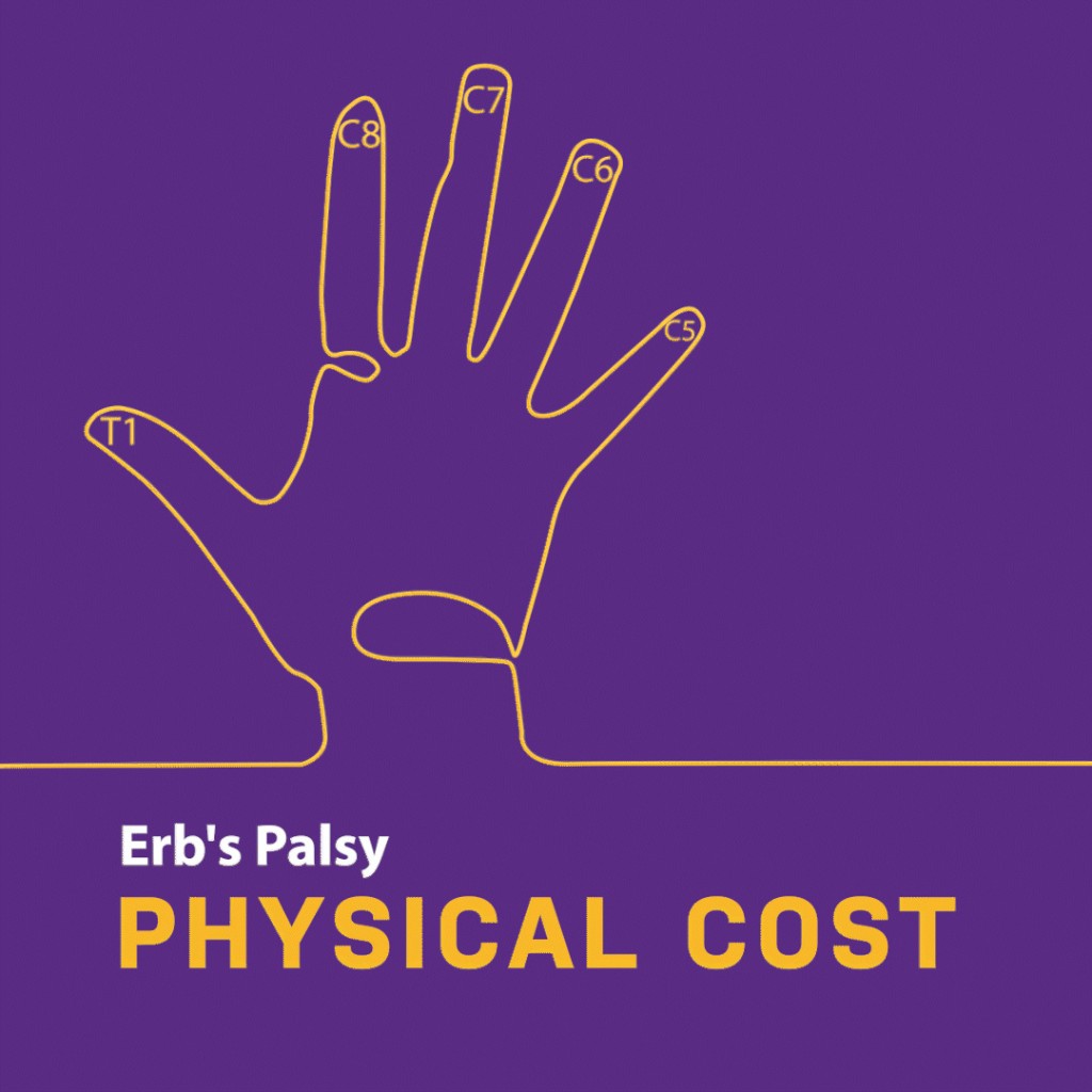Physical Cost of Erb’s Palsy