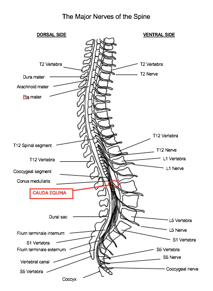 What is Cauda Equina