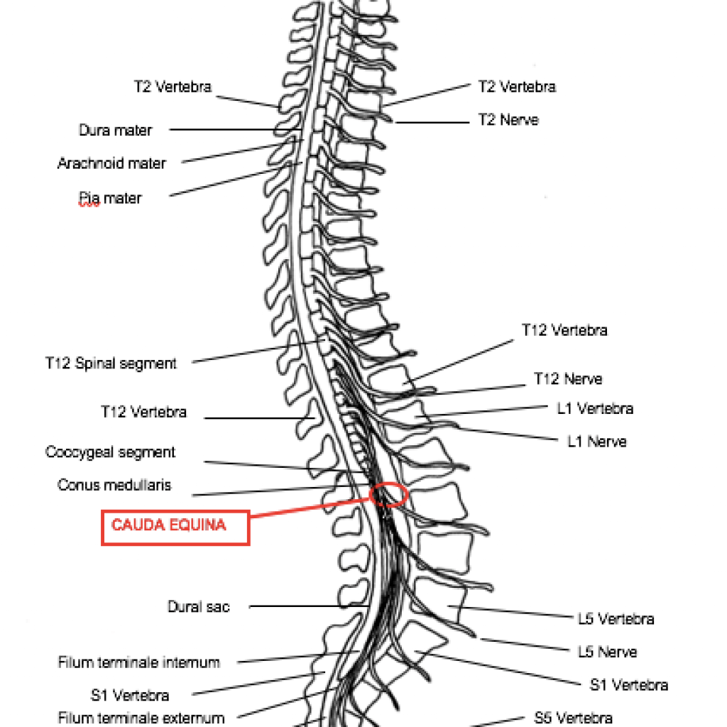Spinal Cord Cauda Equina Conus Medullaris
